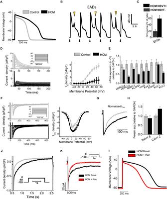 Altered Ca2+ and Na+ Homeostasis in Human Hypertrophic Cardiomyopathy: Implications for Arrhythmogenesis